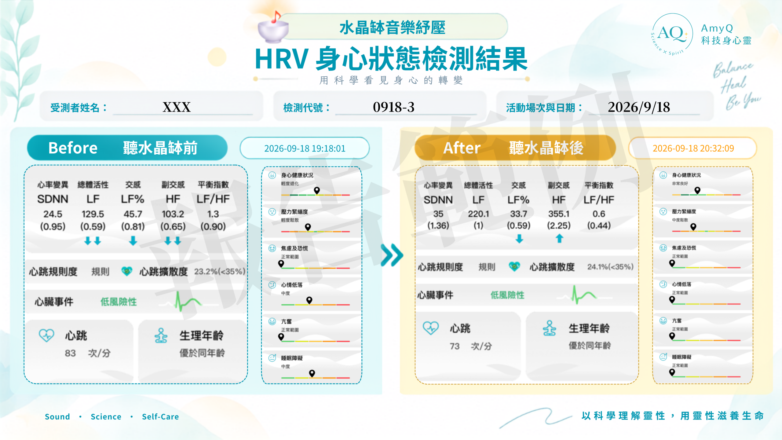 HRV 身心狀態檢測結果 Before / After 對照報告範例（個人資訊已隱藏）
